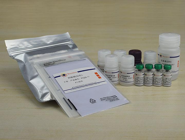 Rat IL-6 ELISA Kit